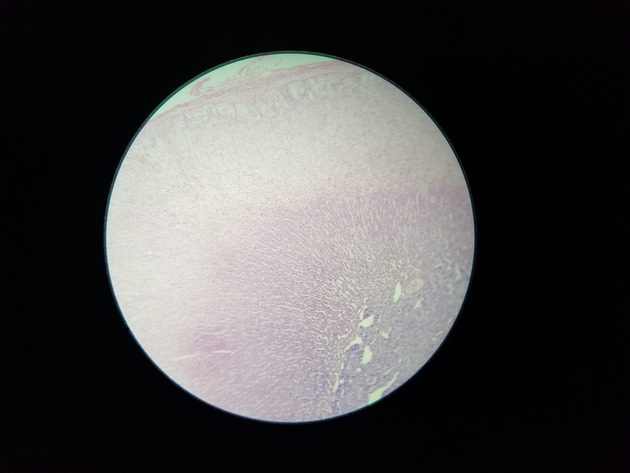 Adrenal Slides - Adrenal 005 100X